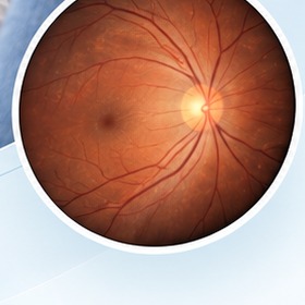 Avaliação e exame detalhado do fundo de olho e retina